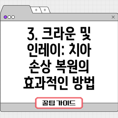 3. 크라운 및 인레이: 치아 손상 복원의 효과적인 방법